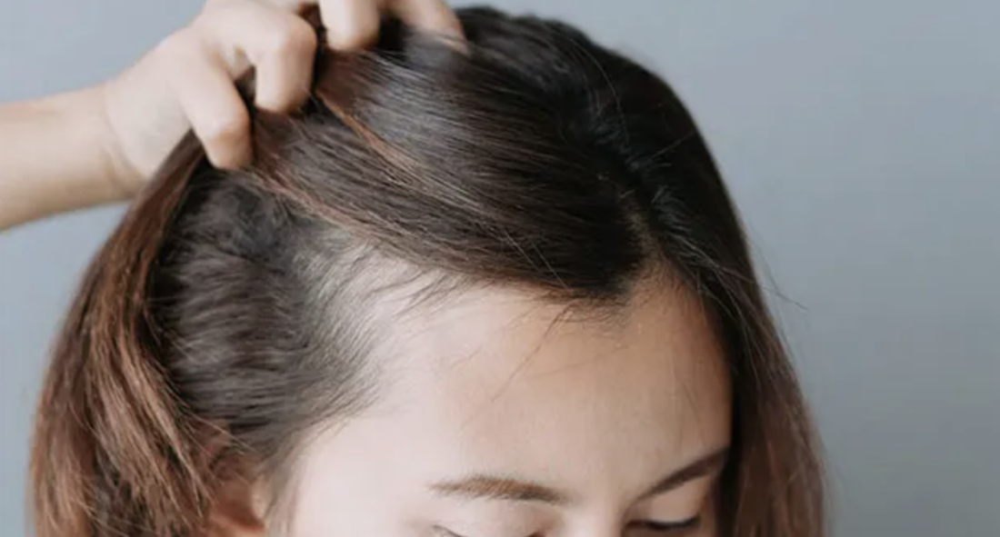 How to deal with postpartum hair loss from tampa salon Tribeca