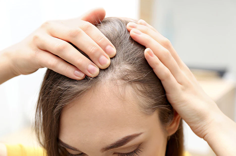 Post Pregnancy Hair Loss Help with Tribeca Salon Tampa